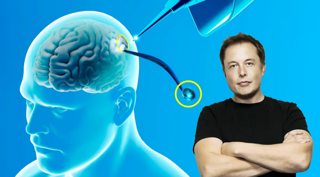 Neuralink